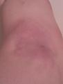 Click image for larger version

Name:	mammoth bruise.jpg
Views:	381
Size:	14.7 KB
ID:	2029890
